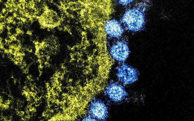 Potential Coronavirus Cases found in Michigan Counties